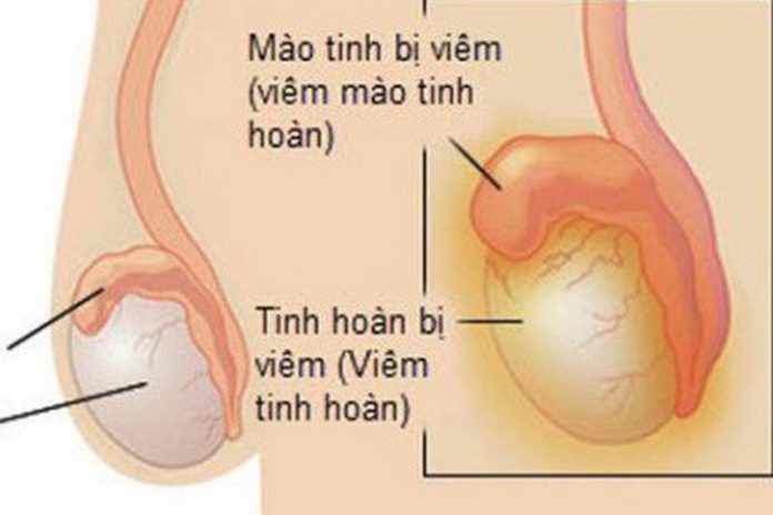 tinh hoan
