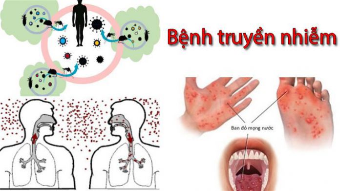 benh truyen nhiem 2